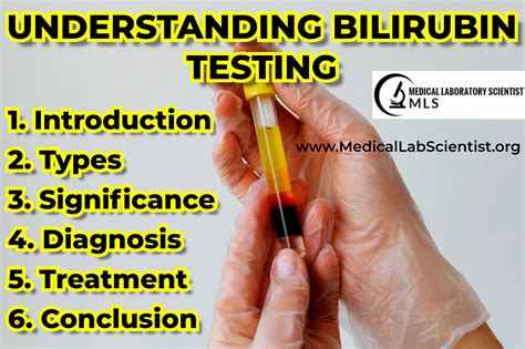 Bilirubin blood test Information .